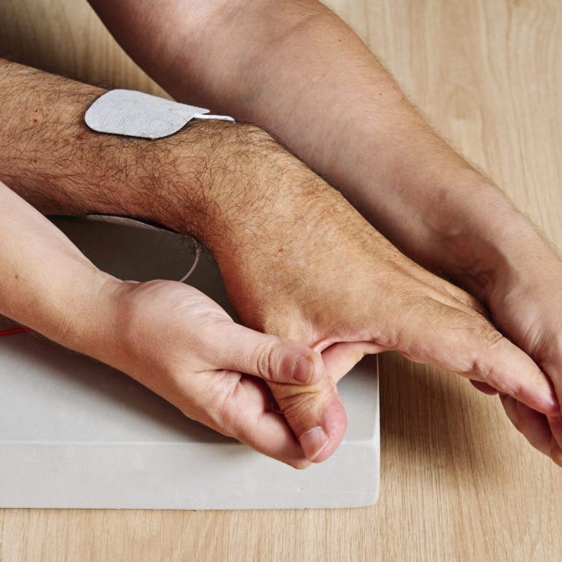 ELECTROESTIMULACIÓN NEUROMUSCULAR (NMES) Y FUNCIONAL (FES)
